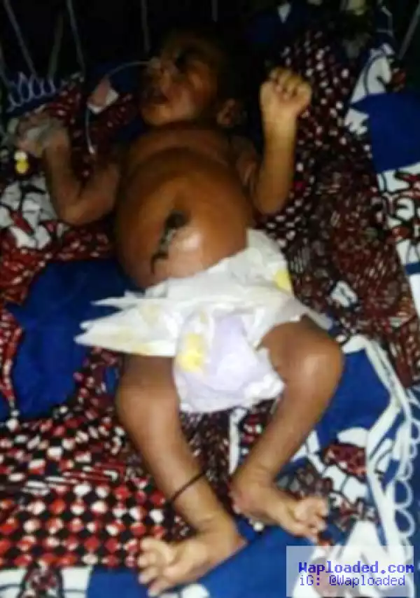 Photo: Baby hospitalized after his stepmother allegedly poisoned him with sniper in Minna
